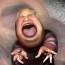 Rush Limbaugh and the Live Volcano